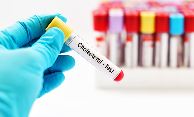Cholesterol-img Cholesterol test in Kent | Intrigue Health.